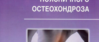Кинезотерапия поясничного остеохондроза — Фищенко В.Я.
